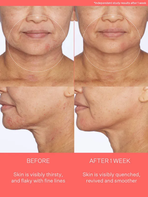 Super Oasis Concentrated Serum